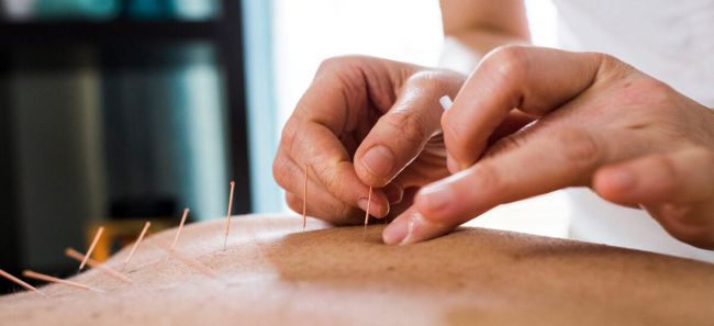 acupunctureneedlesinbackwide.jpg